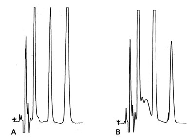 What can be the origin of these extra peaks in run B? 