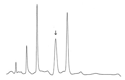 Can you explain these effects in this chromatogram?